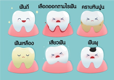 ปัญหาสุขภาพฟัน