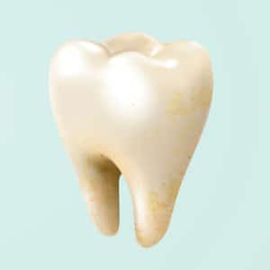 ฟันเหลืองเกิดจากอะไร